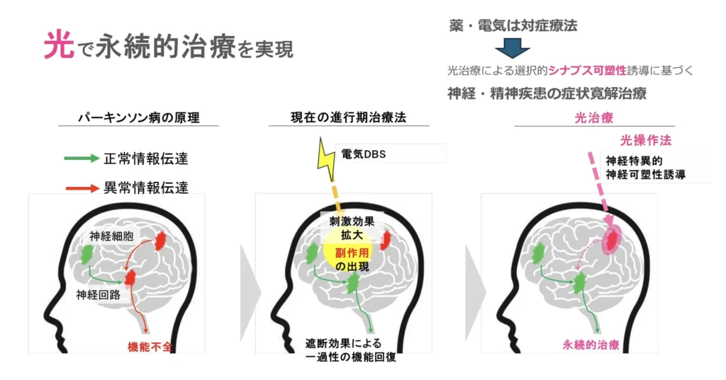 光で永続的治療を実現